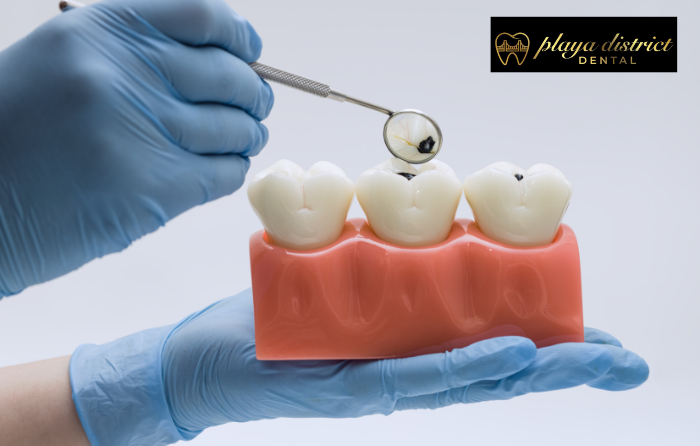 Long-Term Value of Preventive Dentistry