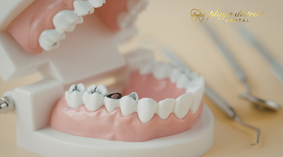 How Dental Implants Affect Speech and Daily Confidence