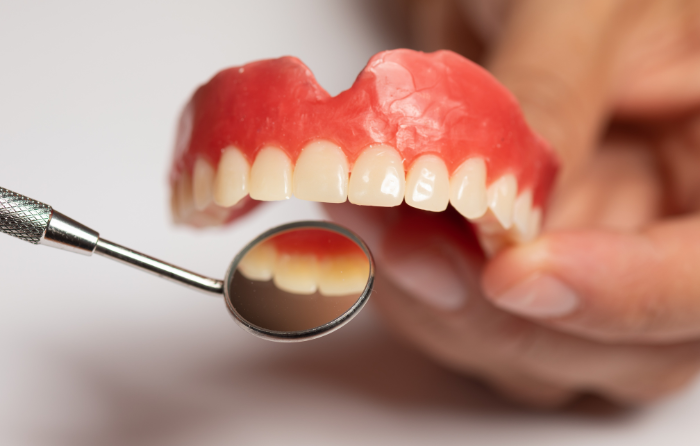 How to Care for Veneers to Make Them Last Longer