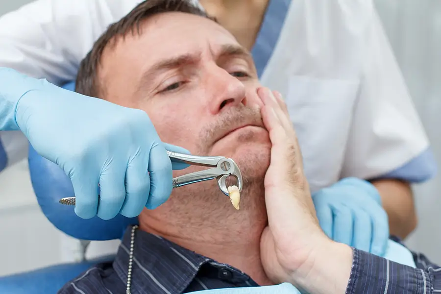 Wisdom Teeth Extractions Los Angeles
