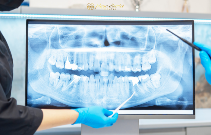 Emergency Dentist Guide_ What to Do in a Dental Emergency